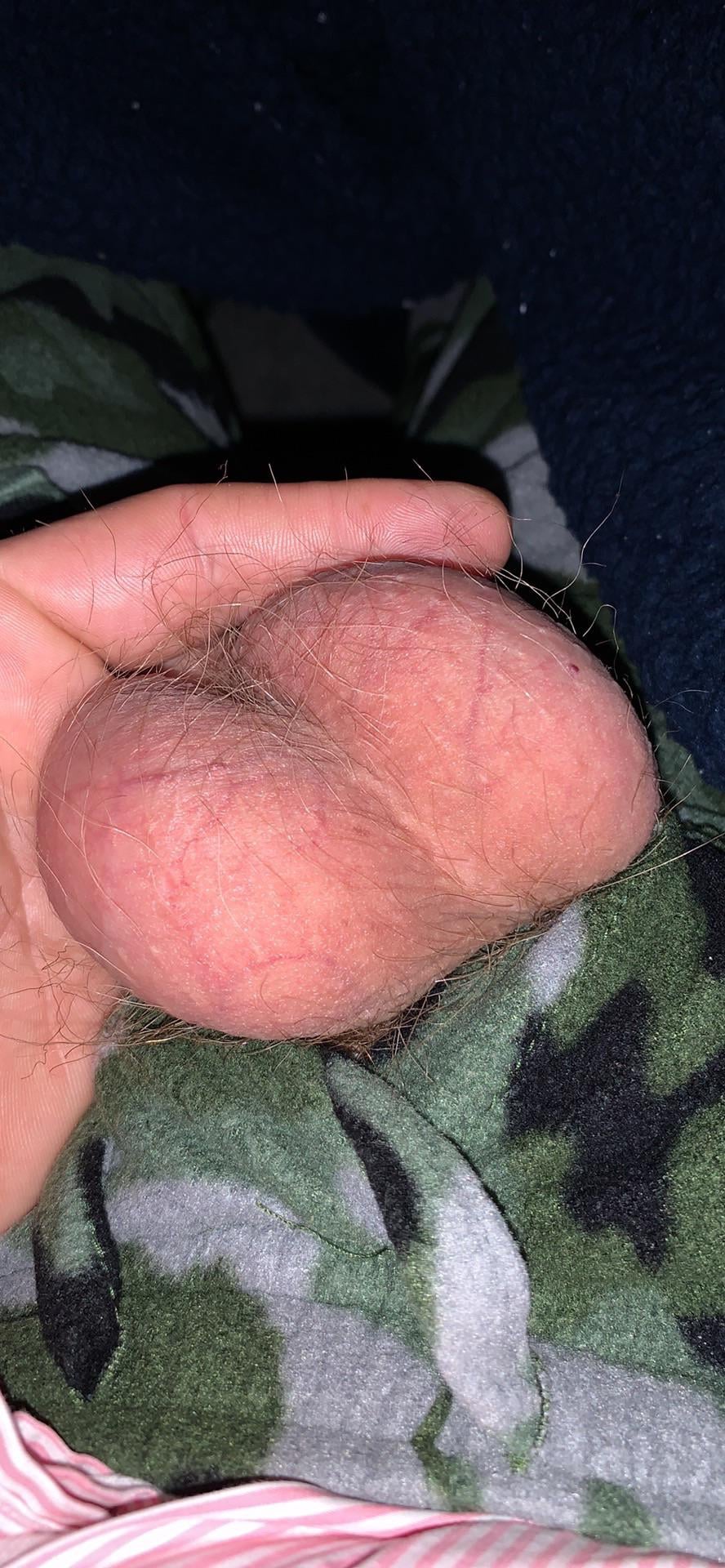 Post image preview