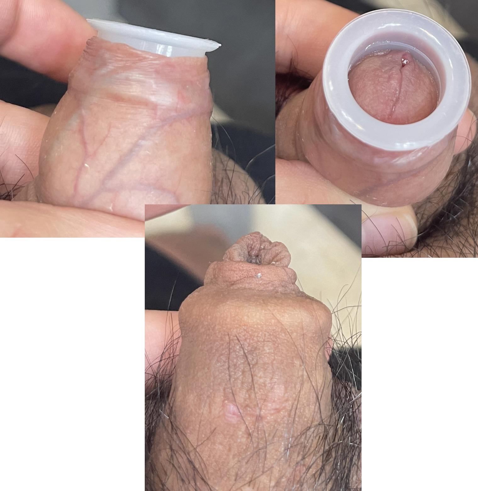 Post image preview